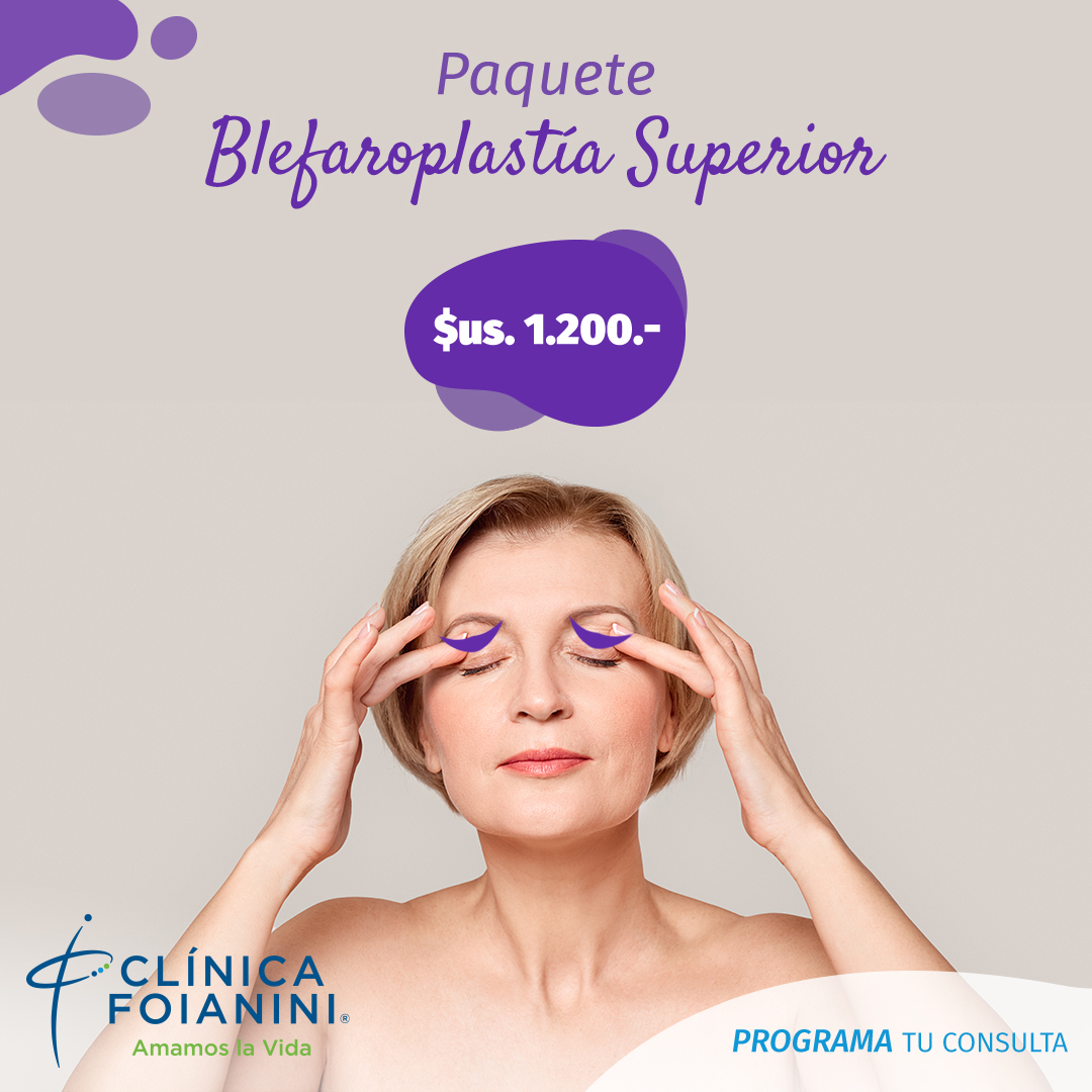 Clínica Foianini - Bleforoplastia superior
