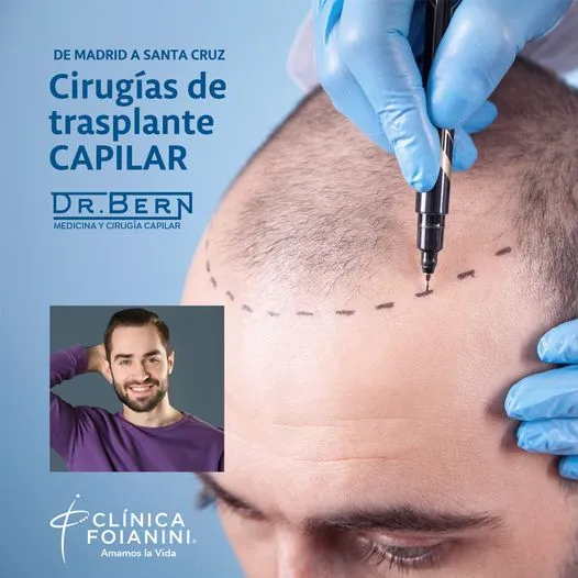 cirugia-transplante-capilar