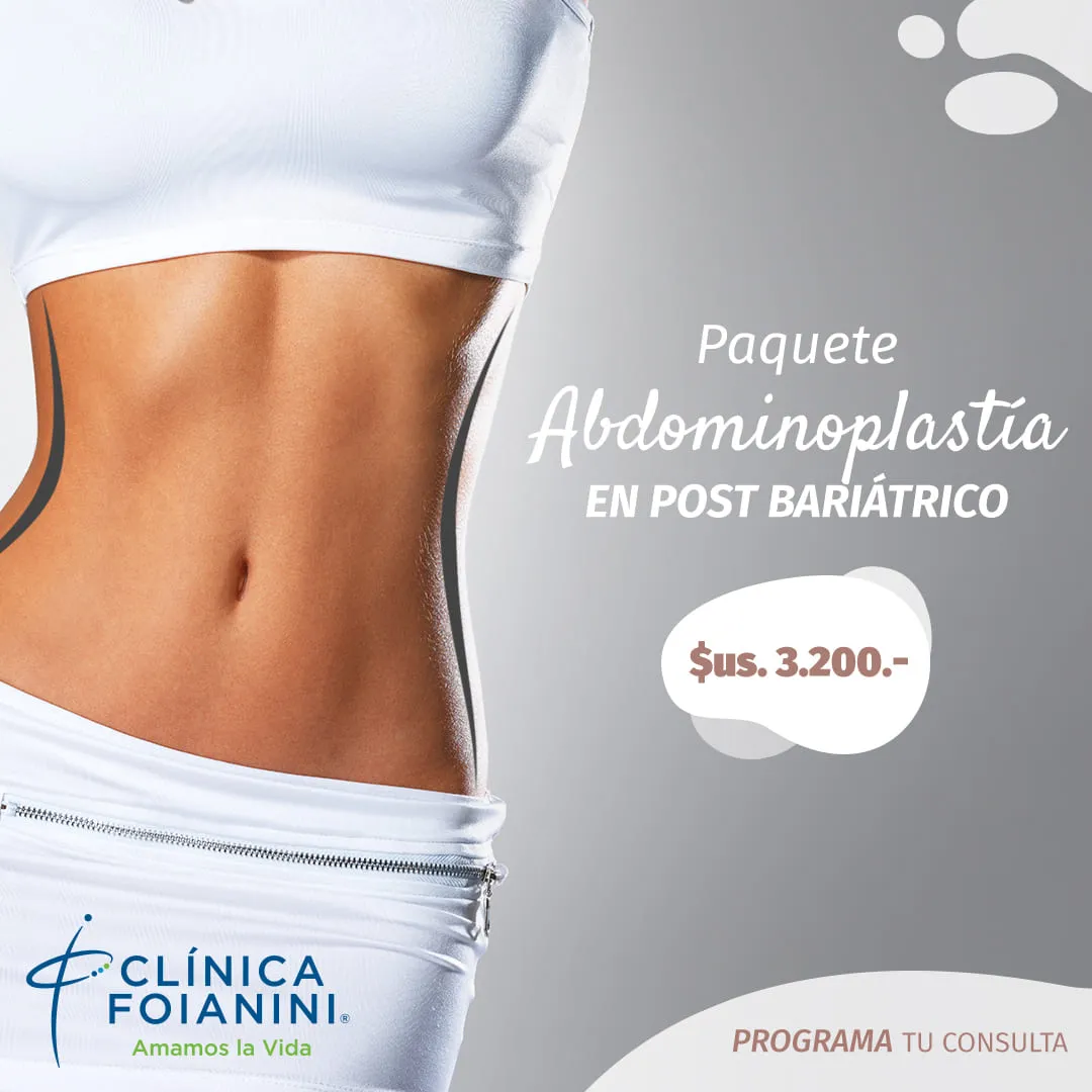 clinica-foianini-abdominoplastia_en_bariatrico