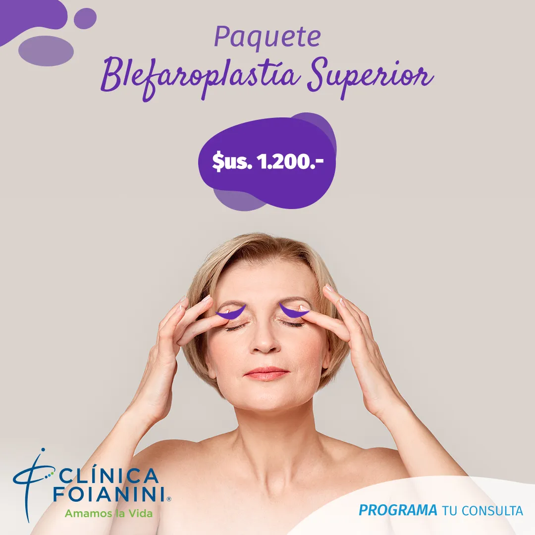 clinica-foianini-blefaroplastia_superior